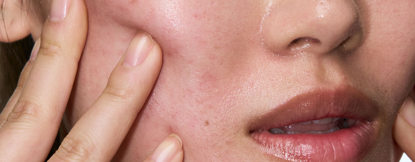 Meet The Spot Solution + The Calming Solution