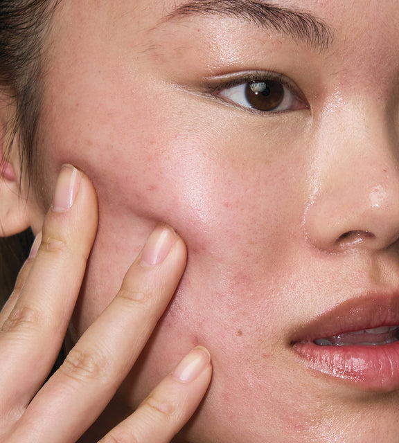 Meet The Spot Solution + The Calming Solution