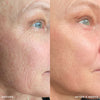 The Retinol Serum